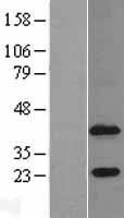 1 AGP acyltransferase 4 (AGPAT4) Human Over-expression Lysate