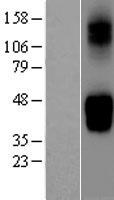 GLUT9 (SLC2A9) Human Over-expression Lysate