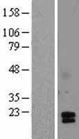 ACRV1 Human Over-expression Lysate