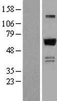 ZNF307 (ZKSCAN4) Human Over-expression Lysate