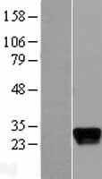 Apolipoprotein M (APOM) Human Over-expression Lysate