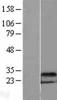 DDIT4 Human Over-expression Lysate