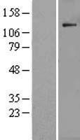 POLR1B Human Over-expression Lysate