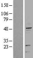 Cytokeratin 20 (KRT20) Human Over-expression Lysate