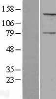 NPAP1 Human Over-expression Lysate