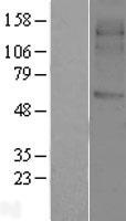SVOP Human Over-expression Lysate