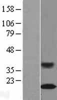 RAG1AP1 (SLC50A1) Human Over-expression Lysate