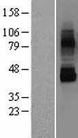 TRPV6 Human Over-expression Lysate