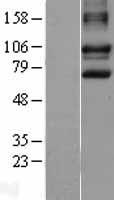 DISC1 Human Over-expression Lysate