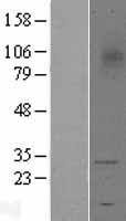 TREM1 Human Over-expression Lysate