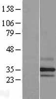 PARL Human Over-expression Lysate