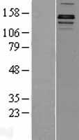 KDM3A / JHDM2A (KDM3A) Human Over-expression Lysate