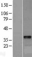 DOK5 Human Over-expression Lysate