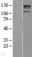 CENPJ Human Over-expression Lysate