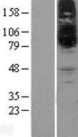 SLC22A15 Human Over-expression Lysate