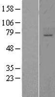 ST6GALNAC1 Human Over-expression Lysate