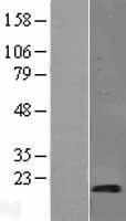 SYNJ2BP Human Over-expression Lysate