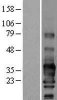 SCN3B Human Over-expression Lysate