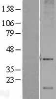 DRAM (DRAM1) Human Over-expression Lysate