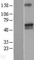 LGI2 Human Over-expression Lysate