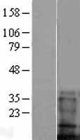 TMEM100 Human Over-expression Lysate