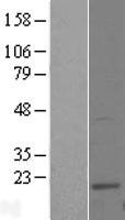 UBE2W Human Over-expression Lysate