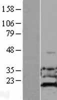 ADI1 Human Over-expression Lysate