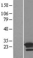 ARL8B Human Over-expression Lysate