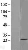 TMEM33 Human Over-expression Lysate