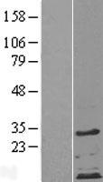 ZDHHC4 Human Over-expression Lysate