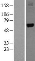 TRMT1 (TRMU) Human Over-expression Lysate