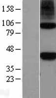 NODAL Human Over-expression Lysate