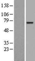 ENOX1 Human Over-expression Lysate