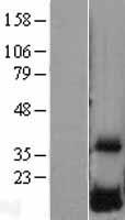 DUSP23 Human Over-expression Lysate