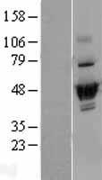 DUS2L (DUS2) Human Over-expression Lysate