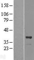 OSGEP Human Over-expression Lysate