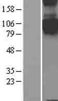 SEMA4C Human Over-expression Lysate