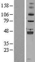 ALKBH5 Human Over-expression Lysate