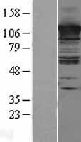 CC2D1A Human Over-expression Lysate