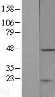 TASP1 Human Over-expression Lysate