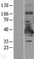 NDE1 Human Over-expression Lysate