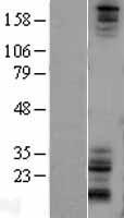 NOTCH1 Human Over-expression Lysate