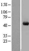 WDR1 Human Over-expression Lysate