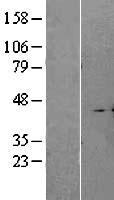 A4GALT Human Over-expression Lysate