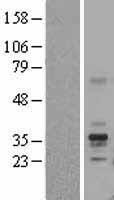 Folate Binding Protein (FOLR1) Human Over-expression Lysate