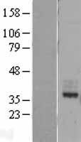 MIR16 (GDE1) Human Over-expression Lysate