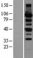 Protein Kinase D2 (PRKD2) Human Over-expression Lysate