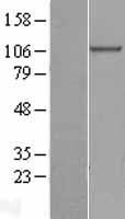 beta COP (COPB1) Human Over-expression Lysate