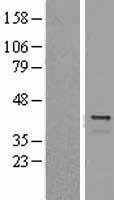TREX1 Human Over-expression Lysate