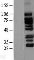 EPLIN (LIMA1) Human Over-expression Lysate